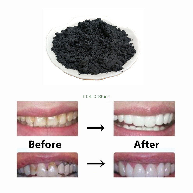 Pure Charcoal Powder, Activate - Activated Charcoal Powder 评论和价格